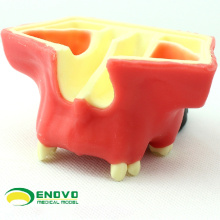 Modelo dental da prática do elevador da cavidade de IMPLANT07 (12615) usado praticando